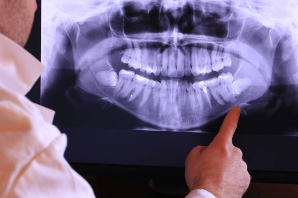 Best Dental Abscess Treatment in Nellysford, VA